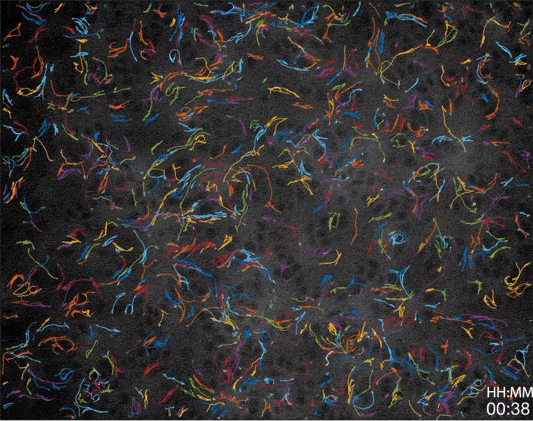 Example of cell trajectories extracted from a time-lapse movie. Each bright white dot is one cell, with a randomly colored trajectory path showing the cell's previous positions. For each high-fluorescent cell there are approximately 2,500 low-fluorescent cells surrounding it. Ellipses indicate aggregate positions detected using the weak florescence of the surrounding cells